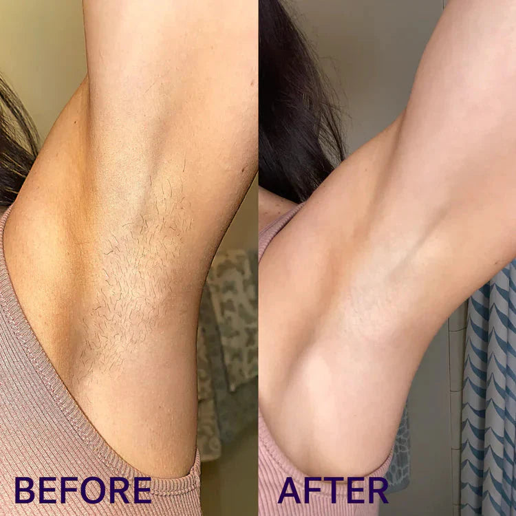 NEWYUO Gentle Hair Removal Spray | Aloe, Ginseng & Hyaluronic Acid | For Men & Women