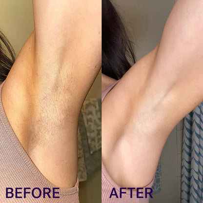 NEWYUO Gentle Hair Removal Spray | Aloe, Ginseng & Hyaluronic Acid | For Men & Women