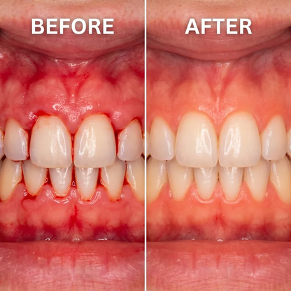 Newyuo Gum Repair Gel | Soothe & Strengthen Gums